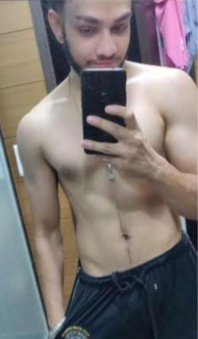 Before photo from a client fitness transformation