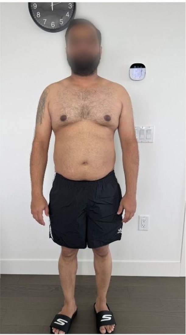 After photo from a client fitness transformation, face softly blurred for privacy
