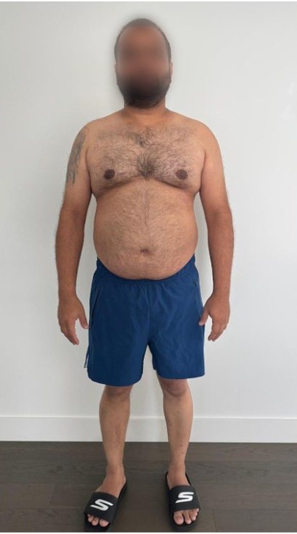 Before photo from a client fitness transformation, face softly blurred for privacy