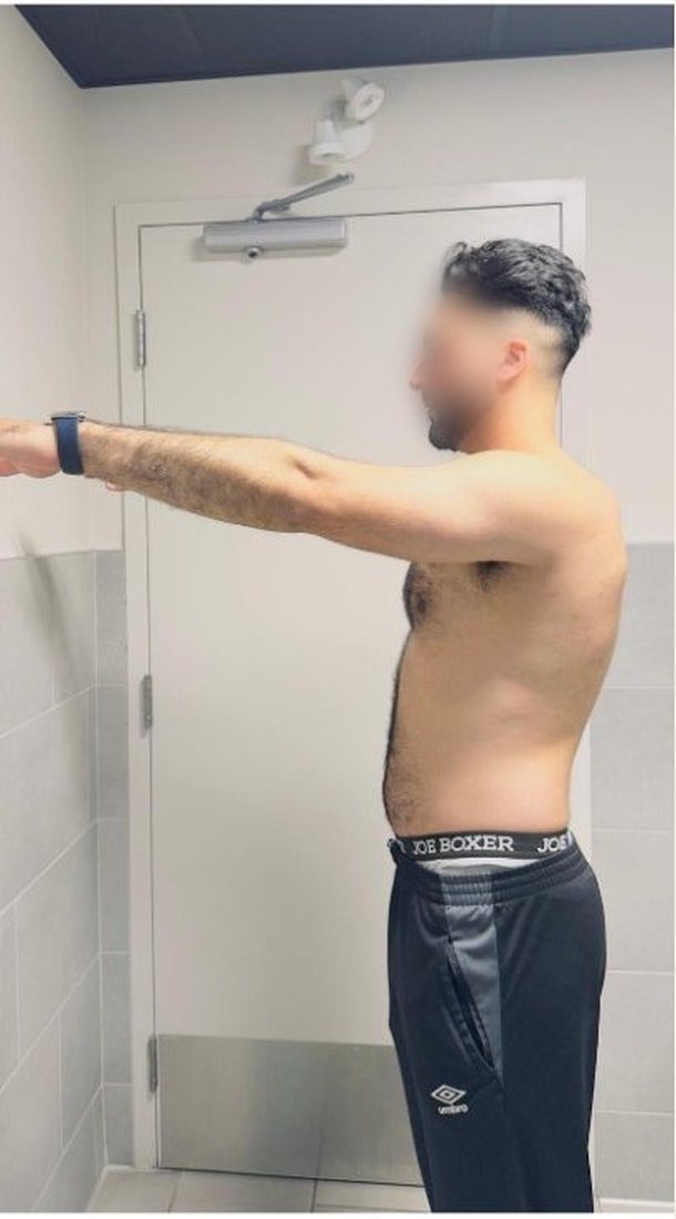 Before photo from a client fitness transformation, face softly blurred for privacy